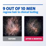 Men’s Rogaine 5% Minoxidil Foam for Hair Regrowth Treatment 1 Month Supply - Image 4