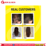 HerbTonics Foli-Tonic Advance DHT Blocker 120 Vegan Capsules - Image 4