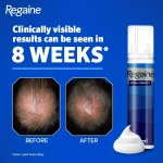 Regaine Foam For Men 3 month supply - 3 x 73ml - Image 3
